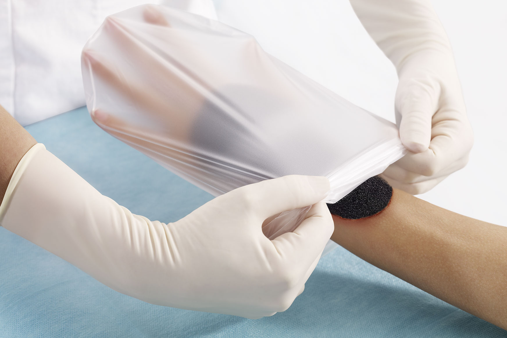 Suprasorb CNP EasyDress